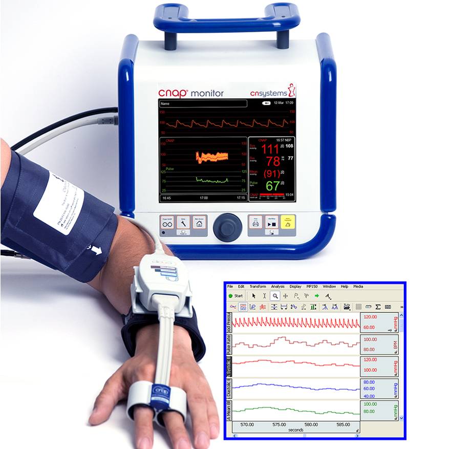 BIOPAC NIBP100D無創(chuàng)血壓采集記錄系統(tǒng),NIBP100D逐跳連續(xù)血壓測量系統(tǒng)