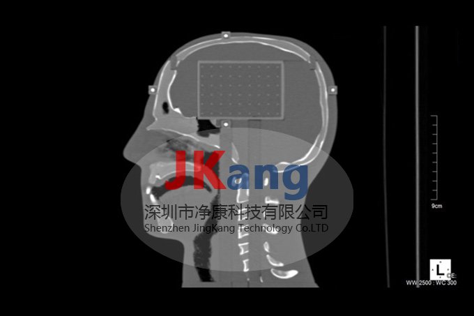 CIRS 038立體定向模體,CIRS 038模體
