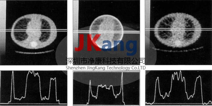 DSC心肺ECT模體,Elliptical LungSpine模體