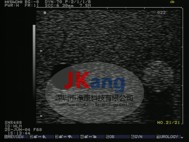 CIRS 054GS型通用超聲體模,054GS超聲體模