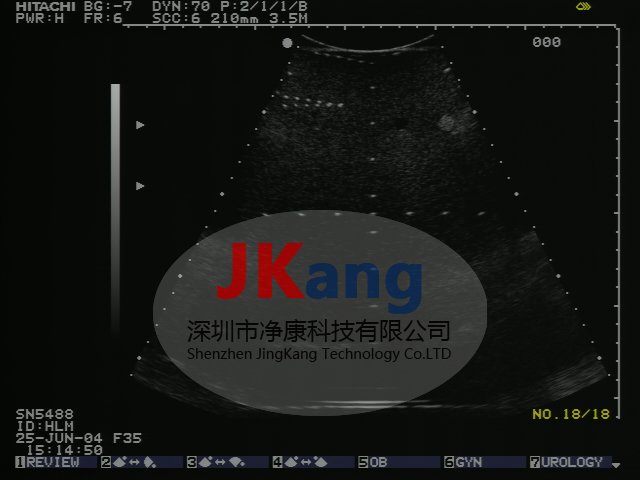 CIRS 054GS型通用超聲體模,054GS超聲體模