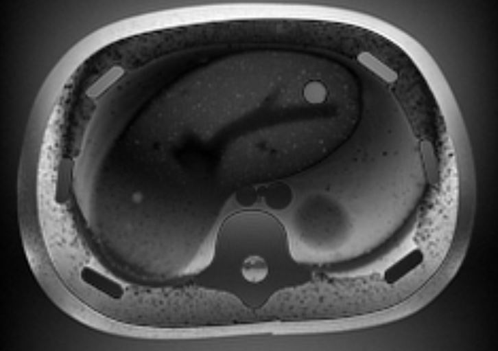 CIRS 057A 3D腹部模體,057A腹部模型