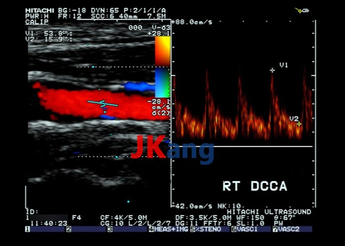 CIRS 043A多普勒弦線體模,SUN NUCLEAR 043A多普勒弦線體模