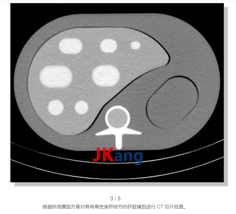 Liver Nodule Phantom肝結(jié)節(jié)模型,QRM-Liver-Phantom肝結(jié)節(jié)模體